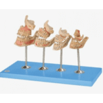 Development of a set of Teeth – Dental Model