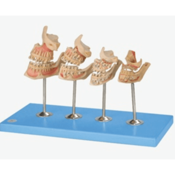 Development of a set of Teeth - Dental Model