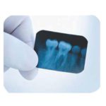 dental_avenue_self_developing_xray_1|dental_avenue_self_developing_xray_2_1|useofxpressd9|dentalx-ray9_1|dentalavenue39032320mn_1