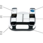 3m_unitek_victory_series_low_profile_brackets_2|dfchrefg|zdfhjre|3m_unitek_vs_lp|dsfgh6yto_