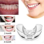 Divine Medicare Orthodontic Trainer & Retainer|htb1cvichpxxxxxmxvxxq6xxfxxx2|e1e581ea-171b-4077-ad5b-1e2359a7ced2|e48d91cb-4552-423f-80d4-8337f84d2fe2|1064c058-9116-4745-84bf-043d025ae8dc